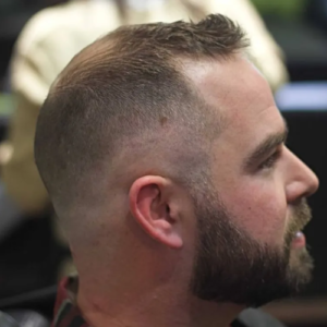 Regulation Cut Hairstyle for Balding Men